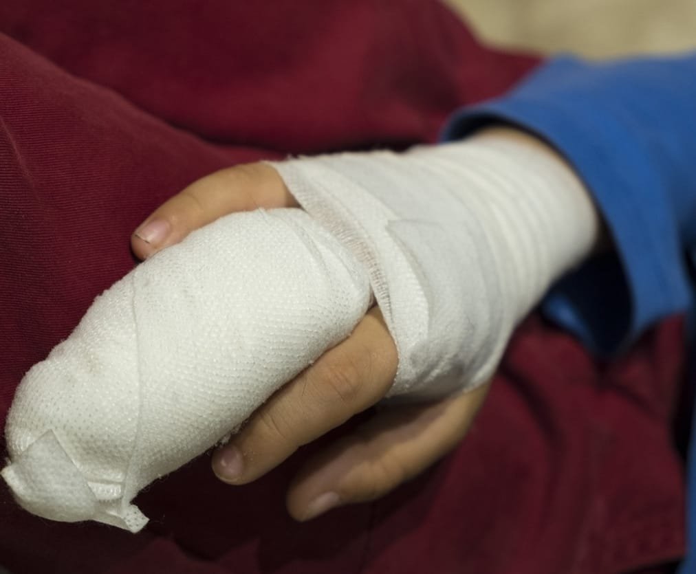 quemados con polvora